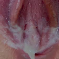 Fat hairy smegma pussy tampon removal jpg x Vaginal smegma