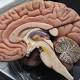 Brains of People With Schizophrenia Try to Repair Themselves: Study 