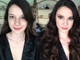 Before and after jpg x Before and after