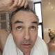 Evidence behind reports of new baldness cure is a little thin 