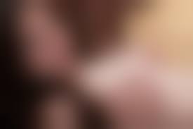 budding nipples|Some advice if it's me being deluded or it's actually budding I'm very  confused : r/TransBreastTimelines