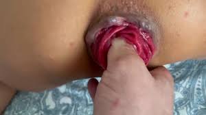 Prolapse sucking jpg x Prolapse sucking