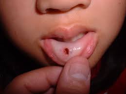 小学生  自撮り  乳首|同期に「観察日記」をつけられ…長与千種が明かした“壮絶なイジメ”の記憶「おまえ、負け犬になんのか」クラッシュ・ギャルズ結成前の知られざる苦悩(Number  Web) - goo ニュース