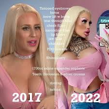 Plastic bimbo porn tube videos tube jpg x Plastic surgery bimbo