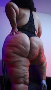 Fat cellulite ass o page jpg x Cellulite ass