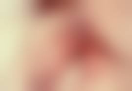  child labia hymen|Genital Examination of the Prepubertal Female: Essentials for Pediatric  Nurse Practitioners - Journal of Pediatric Health Care