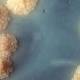 Researchers develop rapid yet inexpensive test for TB - News