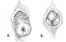 Easaatbaaaaaa dih yhygbxza jpg x Extreme anal prolapse sex