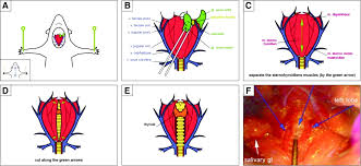 siberian-mouse-naked-7|Frontiers | Flexibility of neural circuits regulating mating behaviors in  mice and flies
