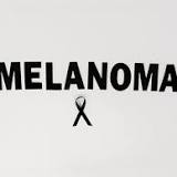 Study identifies unique underlying molecular factors driving melanoma development