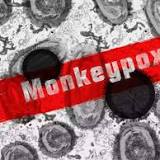 WHO: US has biggest jump in monkeypox cases