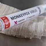 UK Summer Event Organizers Urged to Issue Monkeypox Guidance