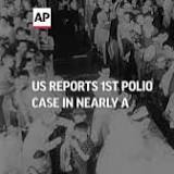 New York May Face 'Tip of the Iceberg' With Polio, Health Chief Says