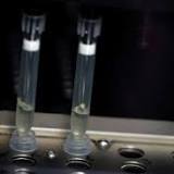 Monkeypox DNA found in semen in handful of cases -researchers say