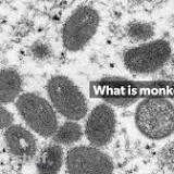 Third case of monkeypox confirmed in New Zealand