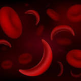 Nephrology nurse decries rise in complications of sickle cell disease in Nigeria, proffer solutions