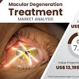 Macular Degeneration Treatment Market Growth Drivers, Investment Opportunity & Product Developments 2032 ...