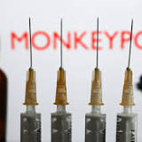 US corrals 36K monkeypox vaccine doses