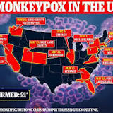 LA County reports first suspected monkeypox case