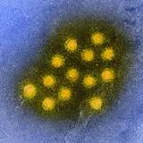 Epidemiology of Hepatitis A in the US Changing