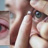 Reusable contact lenses raise risk of rare eye infection, experts warn