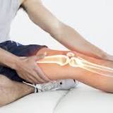 Hyaluronic acid, not very effective against knee osteoarthritis, according to a study