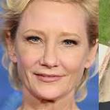 Anne Heche crashes car into a home igniting fire, taken away in ambulance with severe burns: report