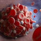 'Robust evidence' Covid blood-thinning drug does more harm than good, concludes new study