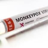 Singapore confirms one imported case of monkeypox