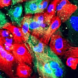 Researchers reveal discovery of mechanism leading to drug resistance in prostate cancer